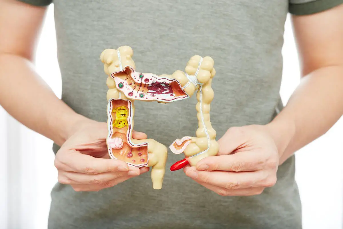 A person in a gray shirt holds a detailed anatomical model of the human colon and the rectum.
